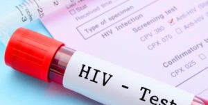 test fai da te per l'Hiv