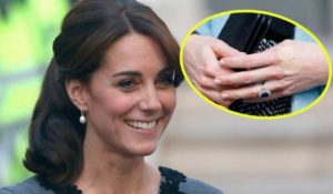 Kate Middleton e il mistero dei cerotti